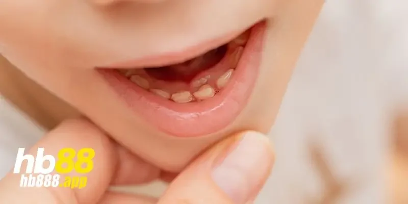 Mơ thấy răng hàm bị rụng