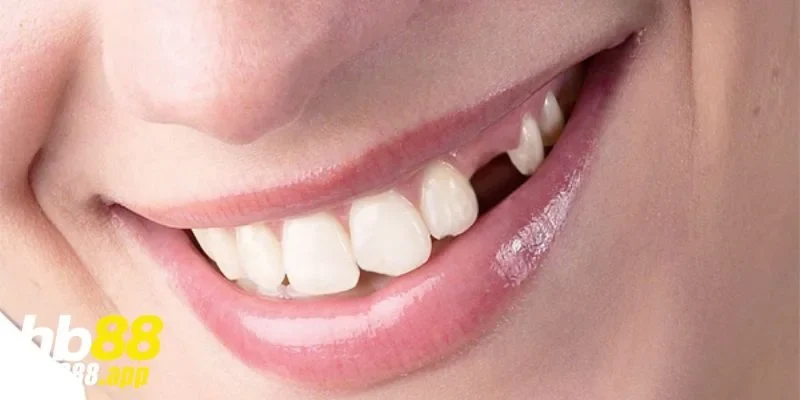 Mỗi giấc mơ rụng răng đều mang ý nghĩa riêng